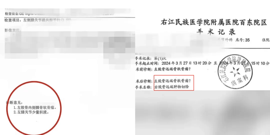 17岁体育生左膝长骨瘤却被错切右膝!母亲:拒绝和解