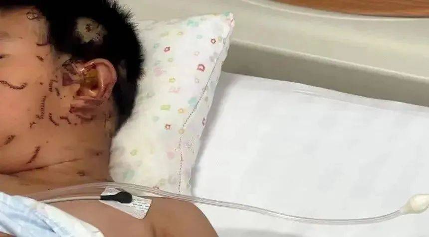 突然爆炸!这个常见保鲜品暗藏危险!